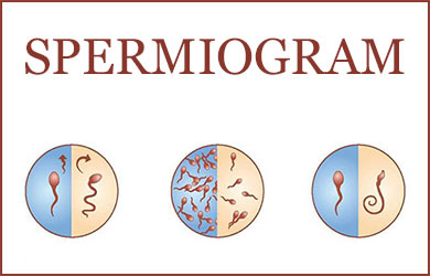 SPERMIOGRAM - všetko, čo by ste o ňom mali vedieť