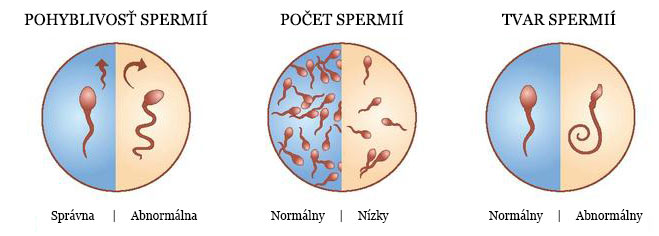 Niektoré vlastnosti spermií, ktoré sa skúmajú pri spermiograme